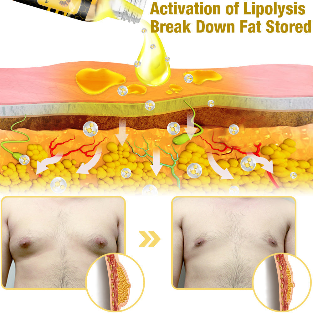 زيت التدفئة GFOUK™ MenTherm Bee Venom Gynecomastia