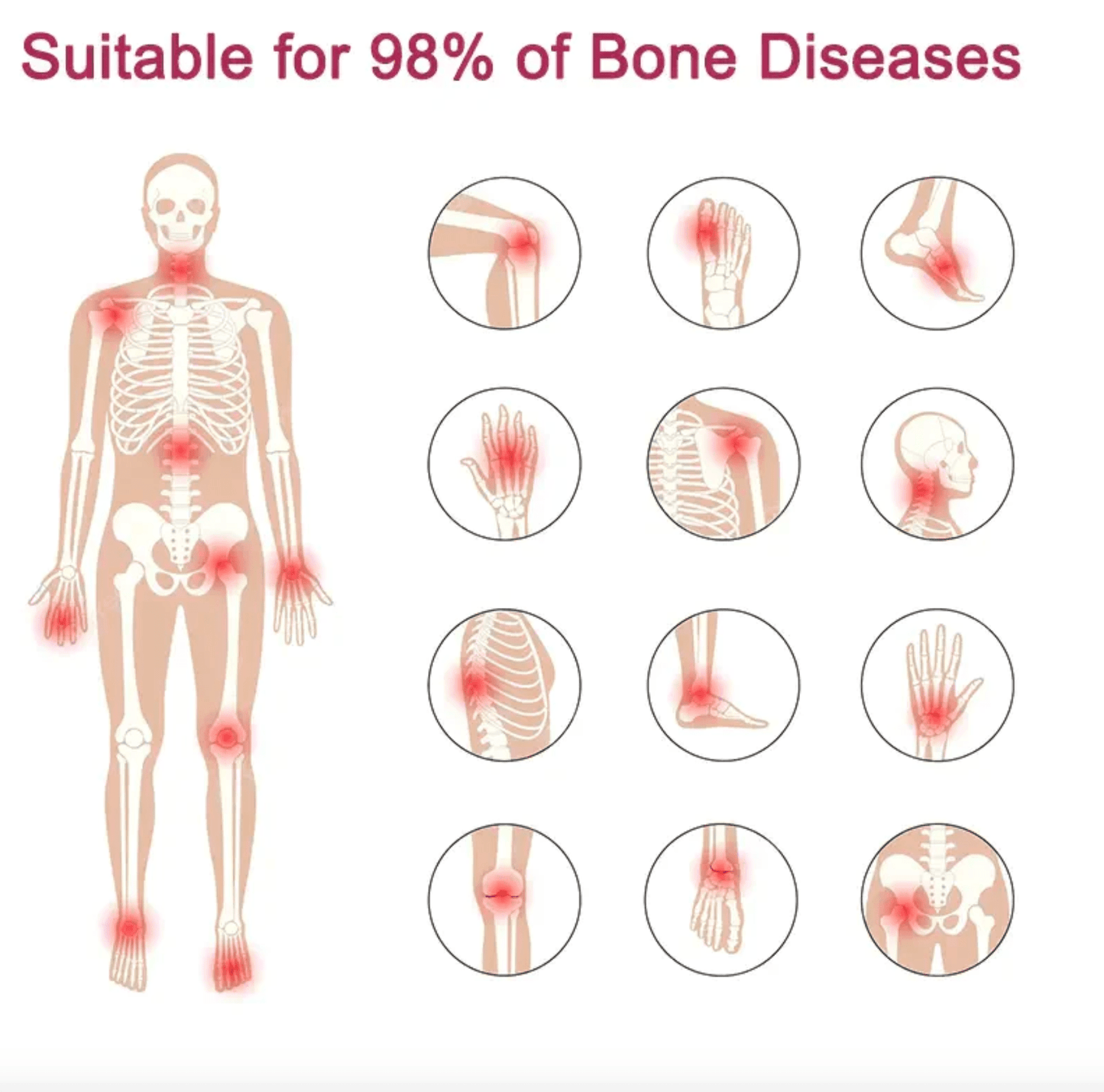 كريم GFOUK™ Perfectx لعلاج المفاصل والعظام