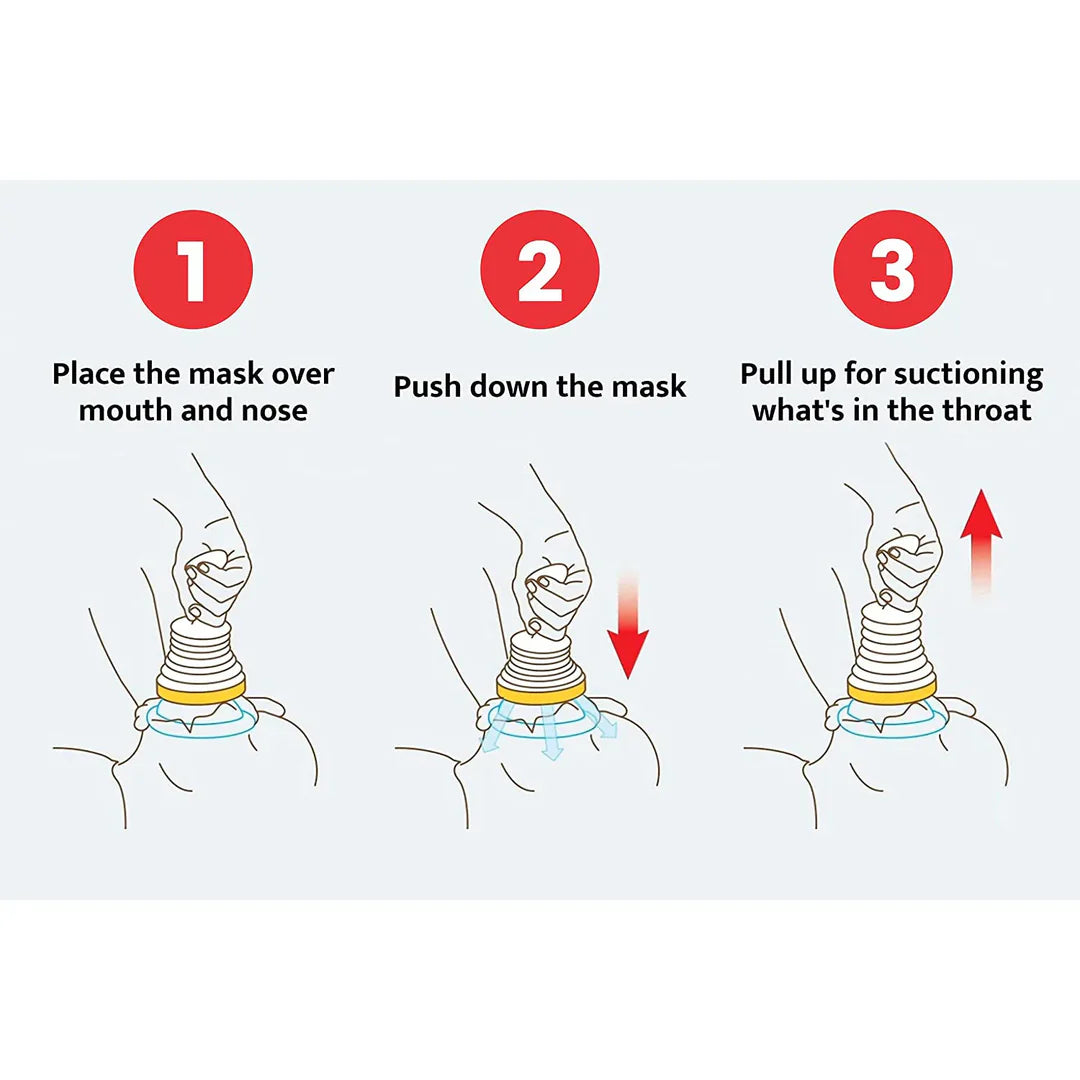 Choking Emergency Device
