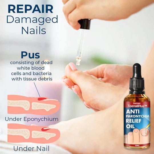 German ToenailPlus™ Anti-Paronychia Relief Oil - flowerence
