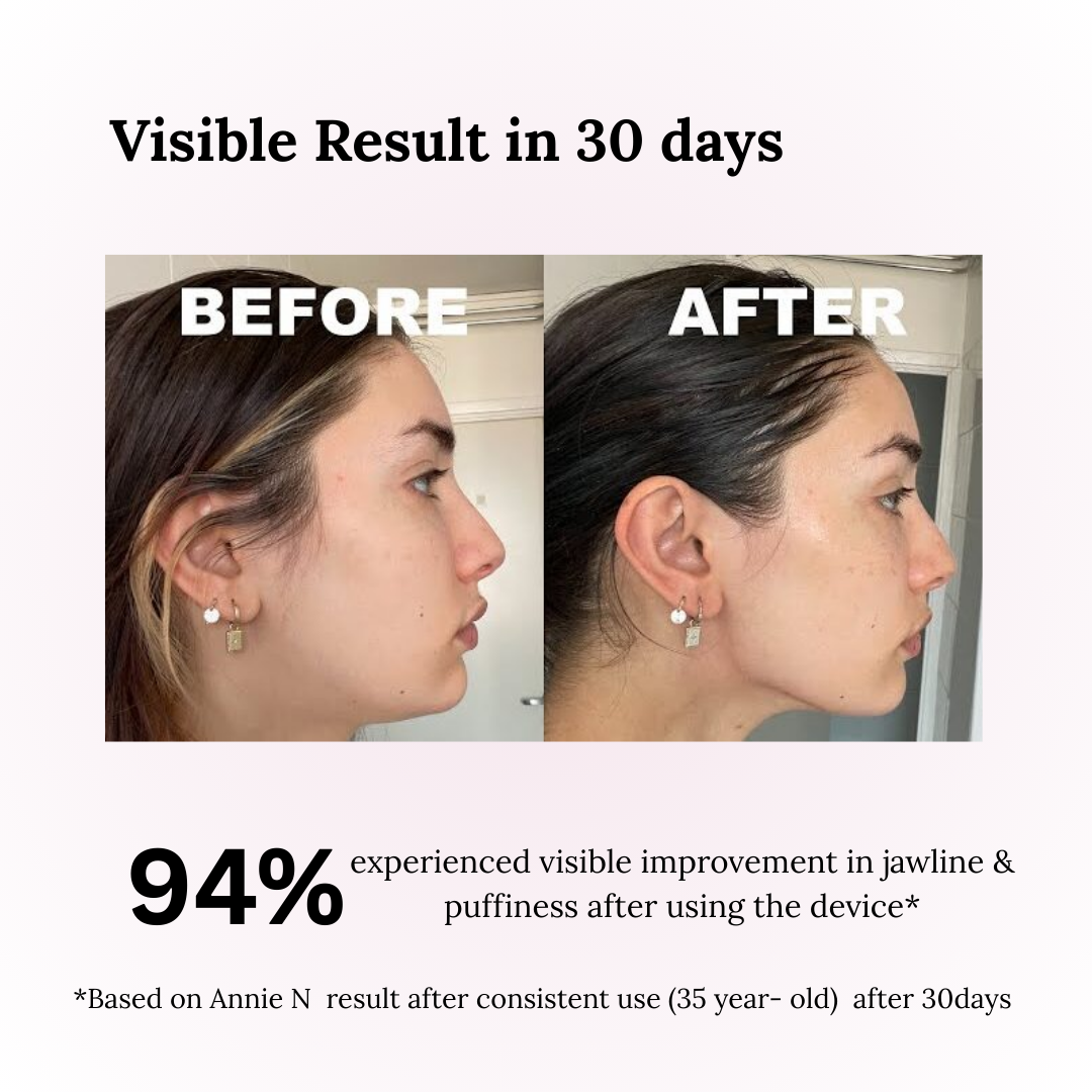 ✨Wireless Facial Massager – Portable Rechargeable Skin Lifting & Puffiness Reducer