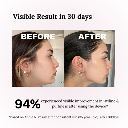 ✨Wireless Facial Massager – Portable Rechargeable Skin Lifting & Puffiness Reducer
