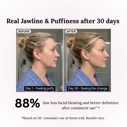 ✨Wireless Facial Massager – Portable Rechargeable Skin Lifting & Puffiness Reducer
