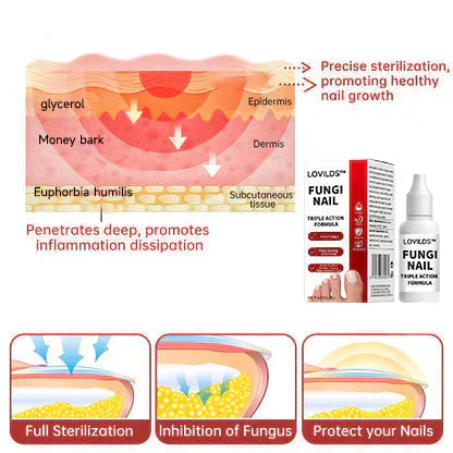 FungaClear Triple-Action Nail Repair - Clear Nails, Renewed Confidence + 1+1 FREE