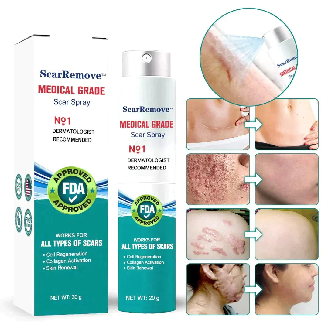 ❤️ScarRemove™ Advanced Scar Spray For All Types of Scars - For example Acne Scars. Surgical Scars and Stretch Marks ⚡️⚡️⚡️