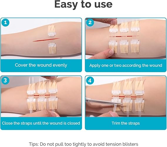 ZipSeal™ Closure Kit