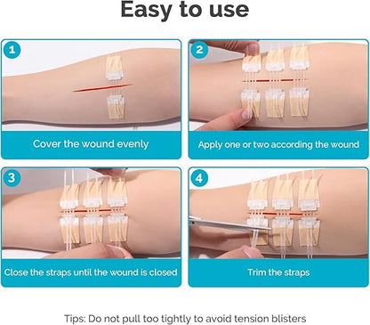 ZipSeal™ Closure Kit
