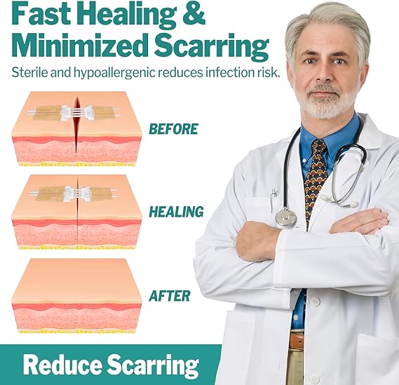 ZipSeal™ Closure Kit