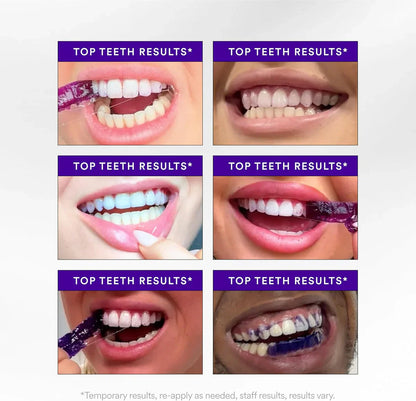 WhiteSmile Teeth Whitening Strips (14 Strips)