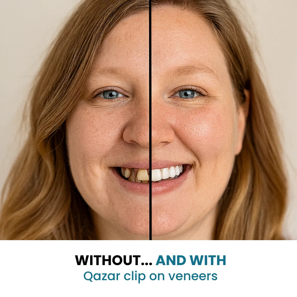 The AuraSmile Veneers - Perfect Smile in 5 Minutes, Dentist-Free Results, and Confidence Boost + 50% OFF