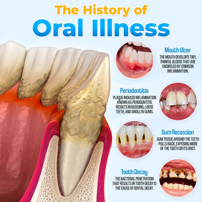 MicroSmile - Reverse Gum Recession. + 50% OFF