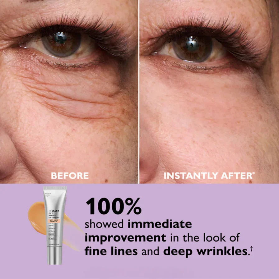Skin Tightener Cream