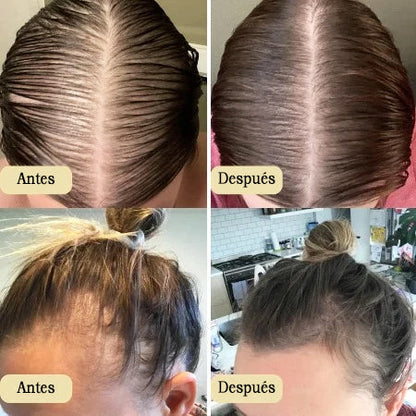 Veganic: Your natural oil treatment for hair growth.