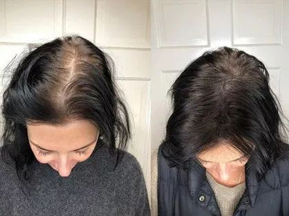 Hair Grower: Electric Scalp Massager