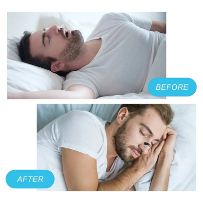 Anti snoring Clip