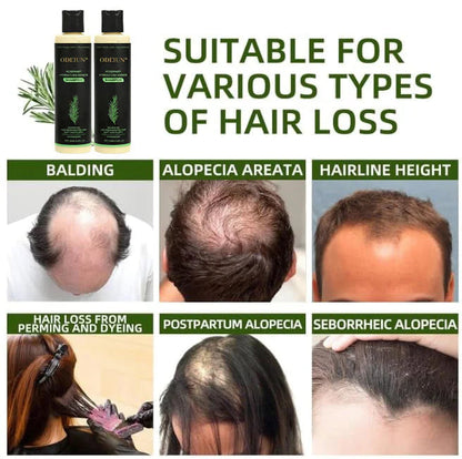  Unlock Thick, Lush Hair That Feels Alive and Strong Every Day