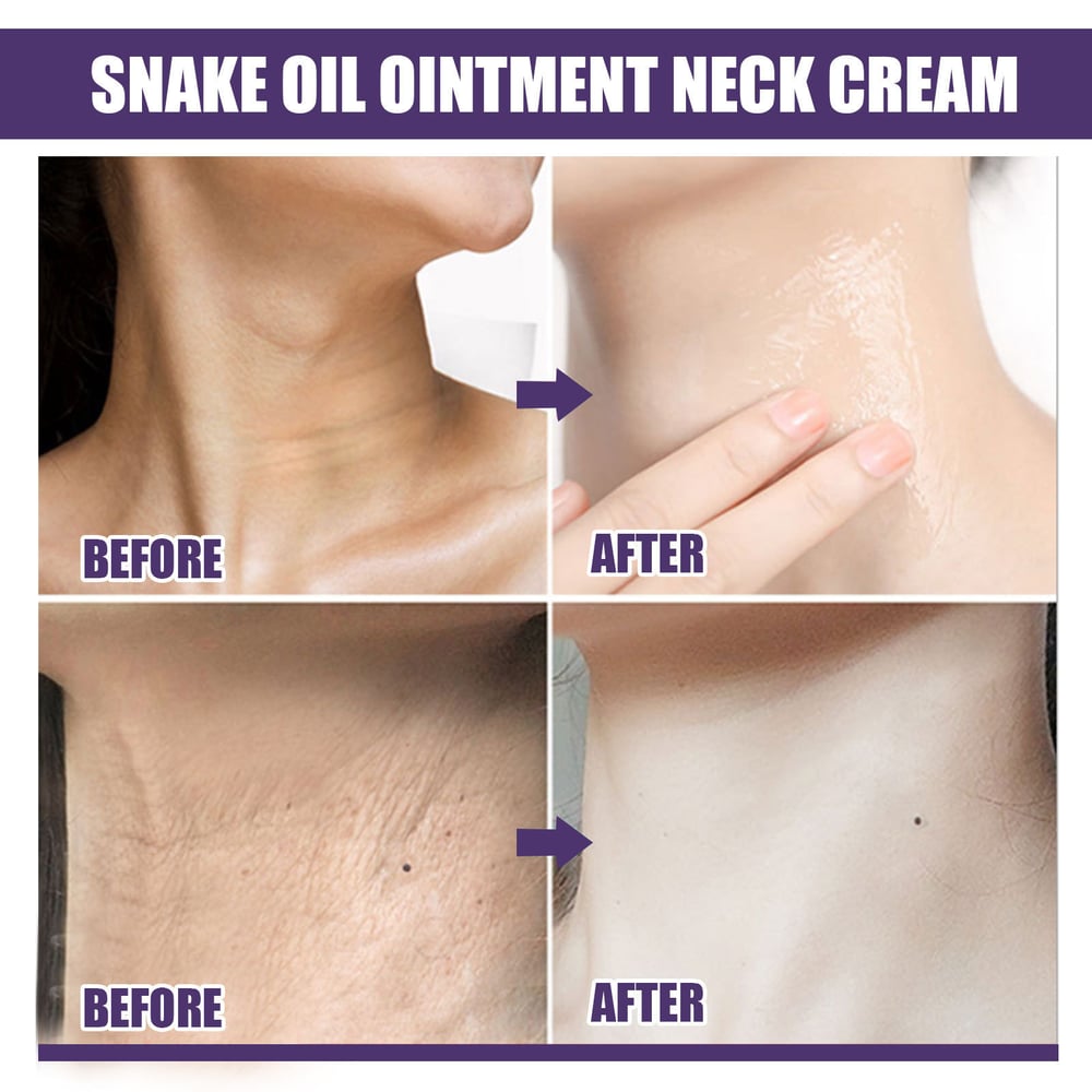 LiftaGlow Sculpt – Erase neck "rings" & tighten sagging skin. 50% OFF