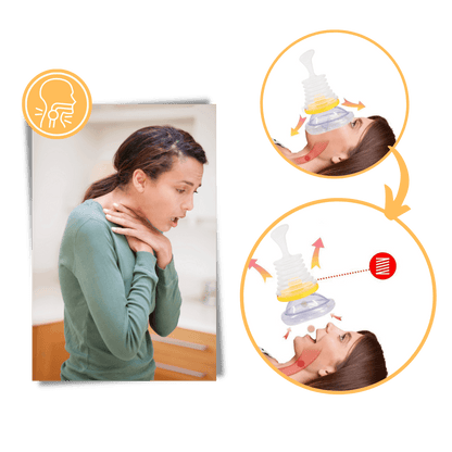 ODEIUN™Life-saving  Anti-Choking Device