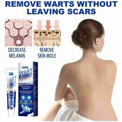 WartAway Herbal Removal Cream