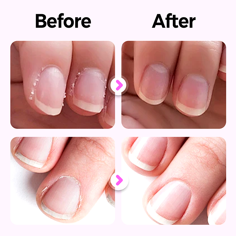 2025 New Upgraded 3-in-1 Nail Care Pen💅